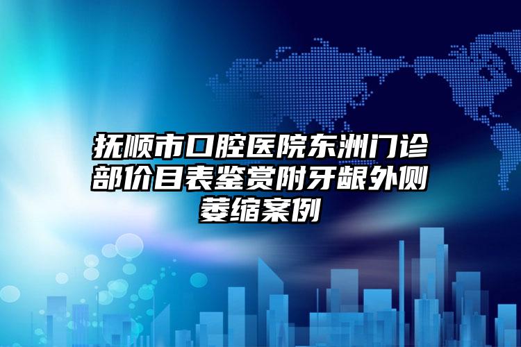 抚顺市口腔医院东洲门诊部价目表鉴赏附牙龈外侧萎缩案例